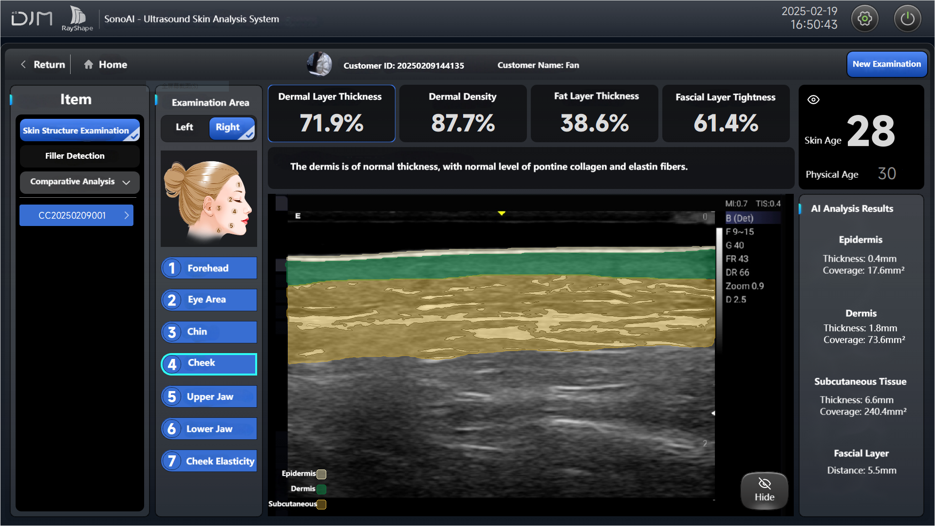 图1 皮肤层次检查-EN