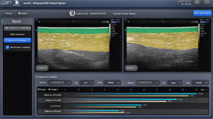 图3 皮肤层次比较分析-EN