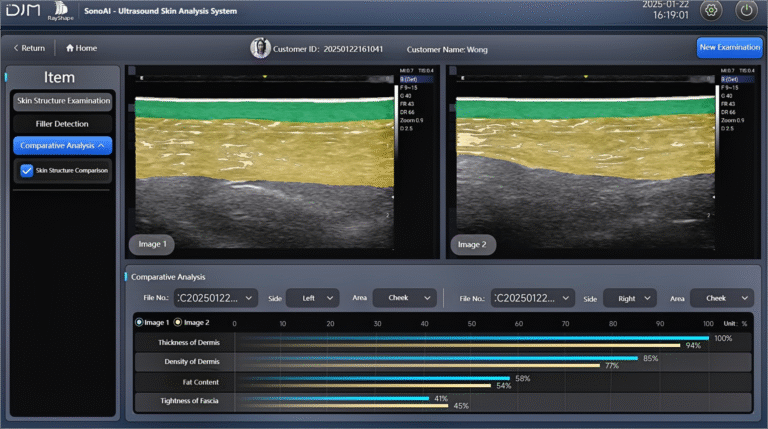 Revolutionizing Dermatology: How AI-powered Ultrasound Skin System Transforms Skin Analysis