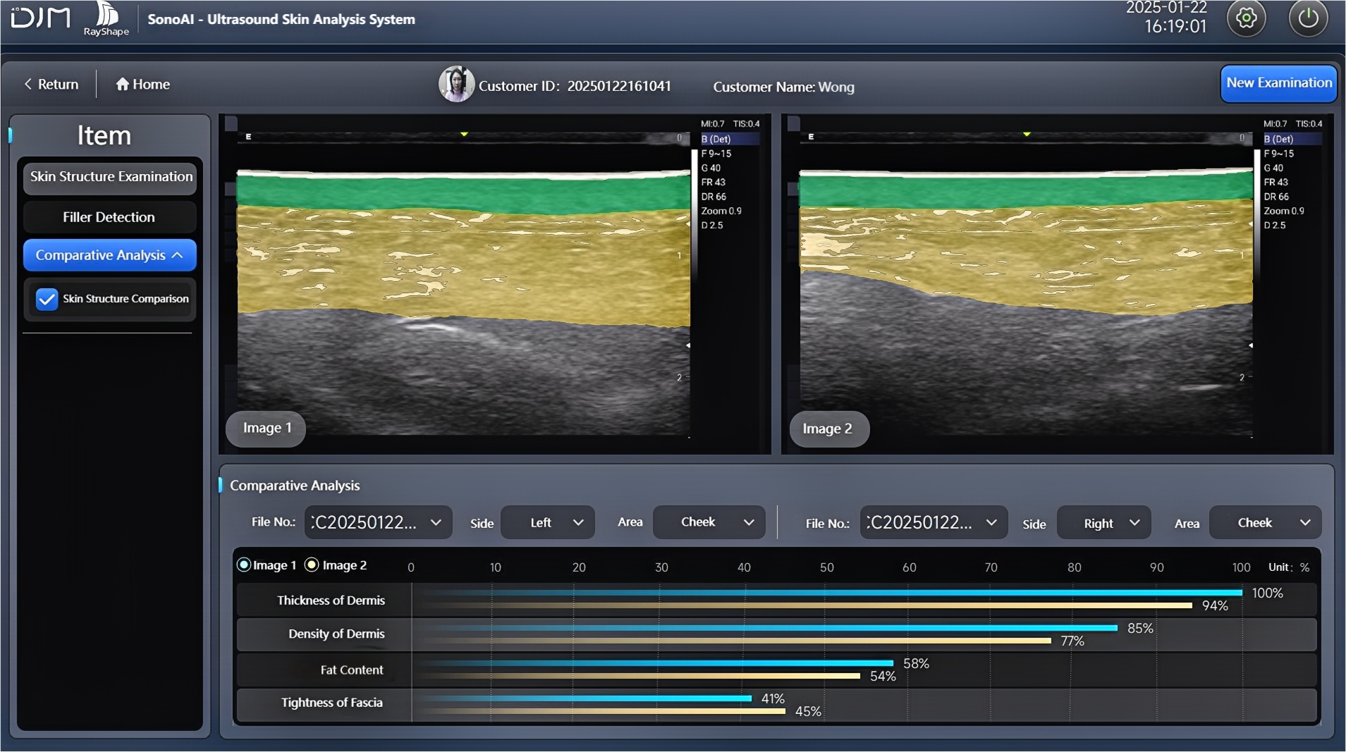 图3 皮肤层次比较分析-EN