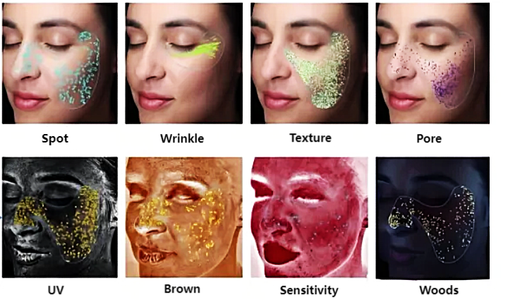 skin analyse result image
